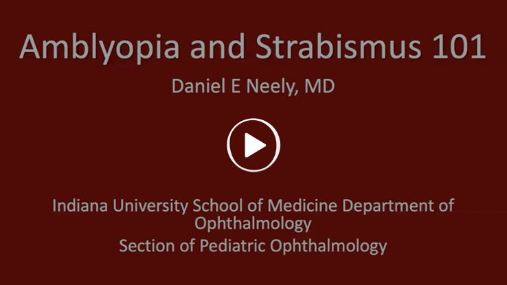 Amblyopia and Strabismus 101 with Daniel E Neely, MD Indiana University School of Medicine Department of Ophthalmology Section of Pediatric Ophthalmology